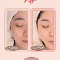 Skin Need + V Lift - Advanced Firming & Contouring Treatment